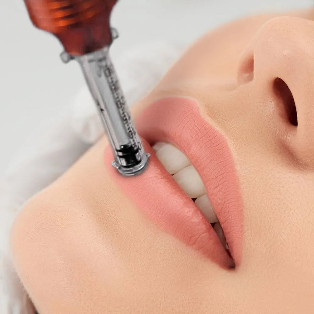 Aumento labial (Hyaluron Pen Lip Filler)